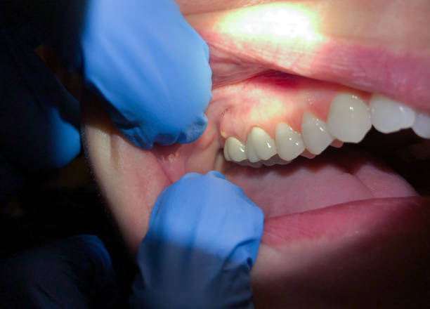 Best Emergency Dental Surgery in Sulligent, AL